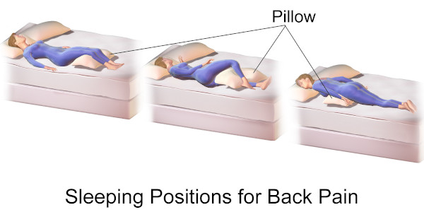 What Can I Do for Back Pain