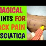 acupuncture points for sciatica